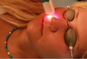 Low-Level-Lasertherapie_in_der_Dermatologie2